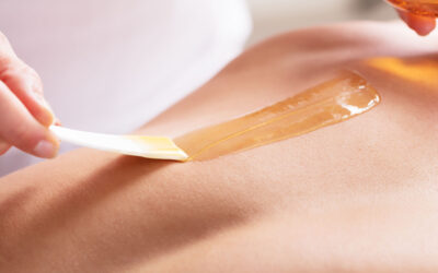 Why More Men Are Investing in Hair Removal Treatments